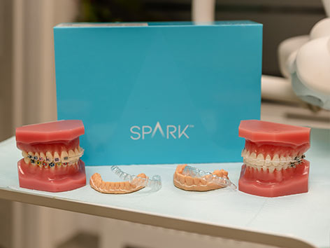 Aparat dentar fix, aparat dentar metalic cluj, aparat dentar safir cluj, aparat invizibil Spark cluj